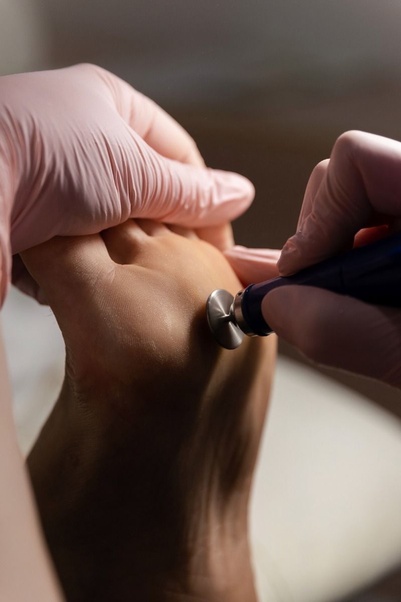 Specialized Pedicure