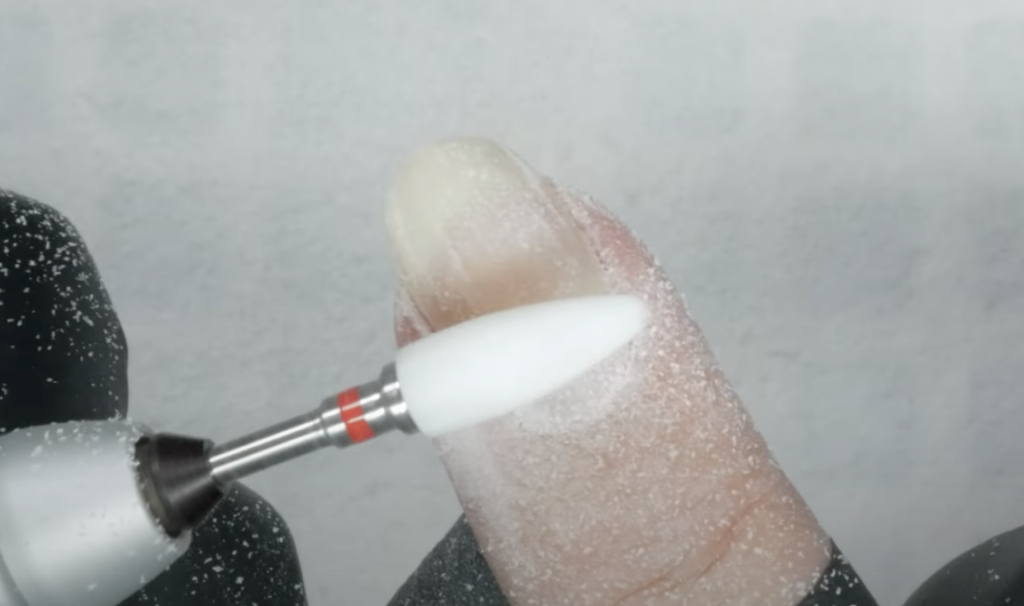 Gel Removal