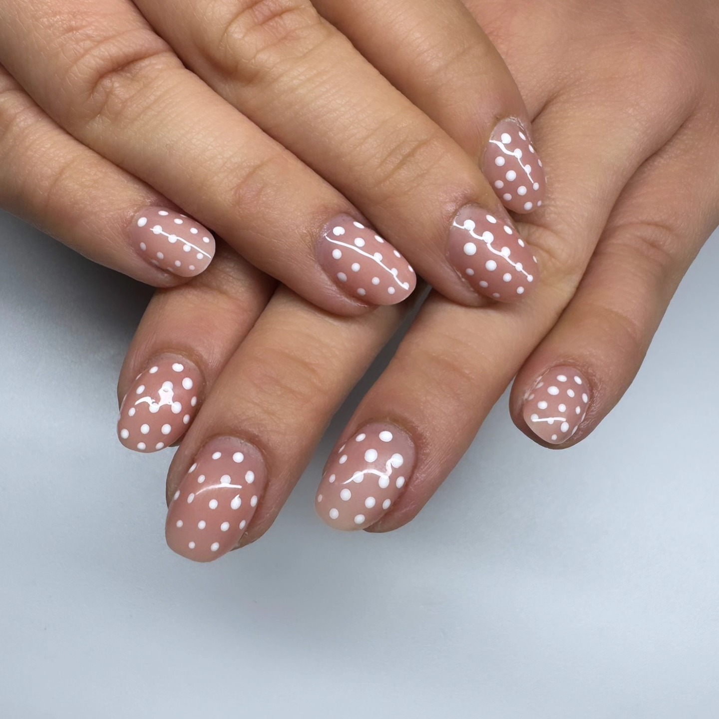 Gel Overlay