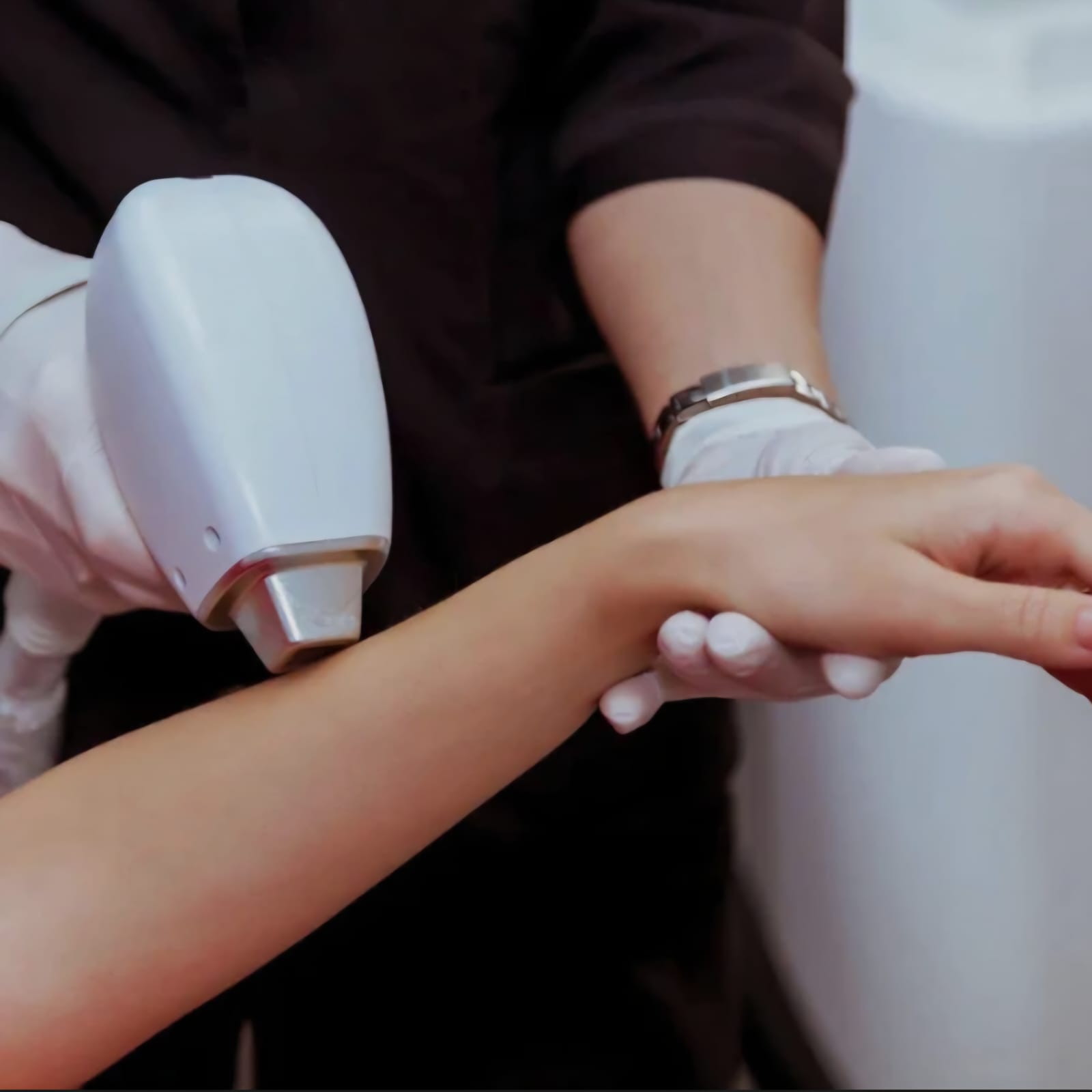 Arms Laser Hair Removal