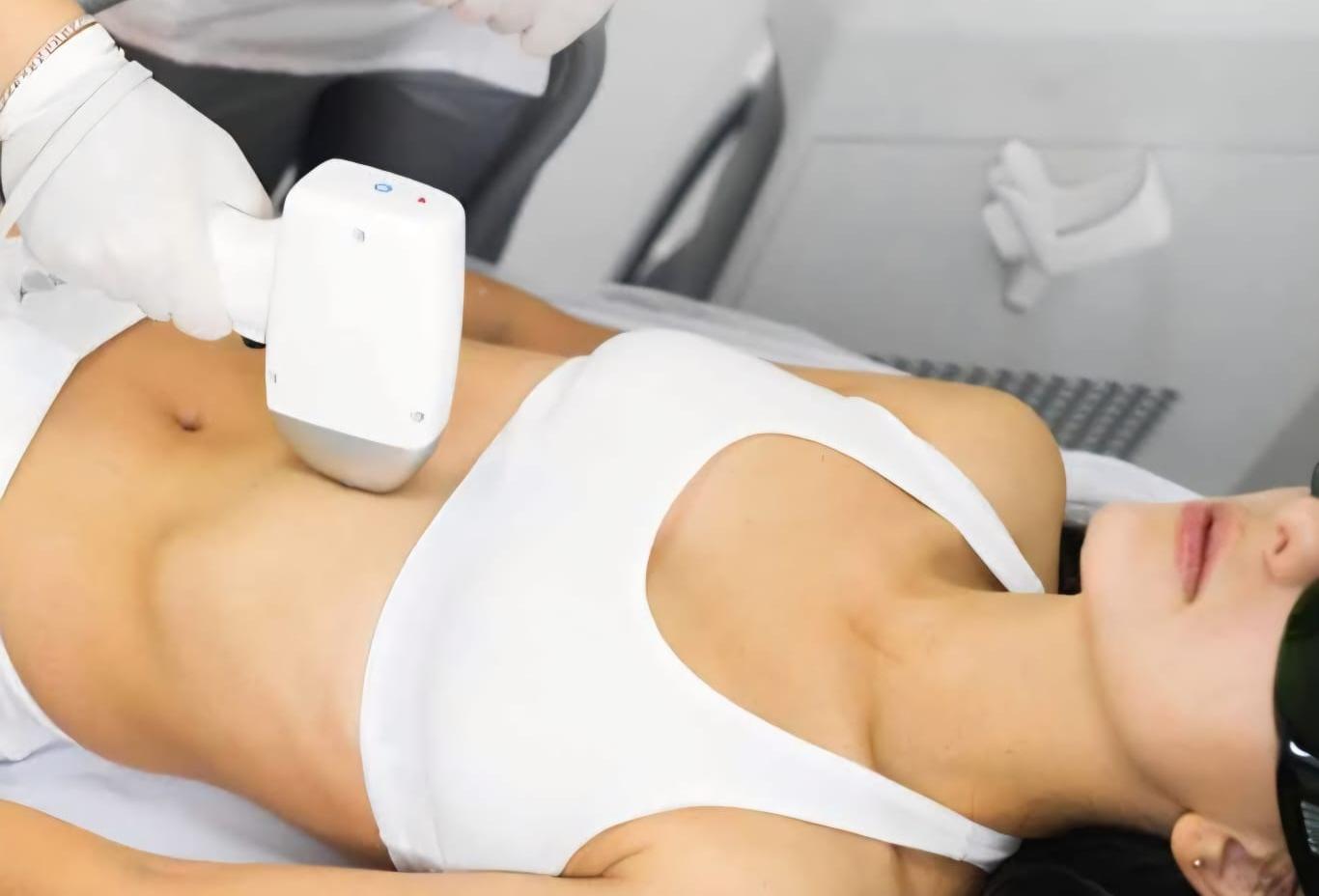 Abdomen or lower Back Laser Hair Removal
