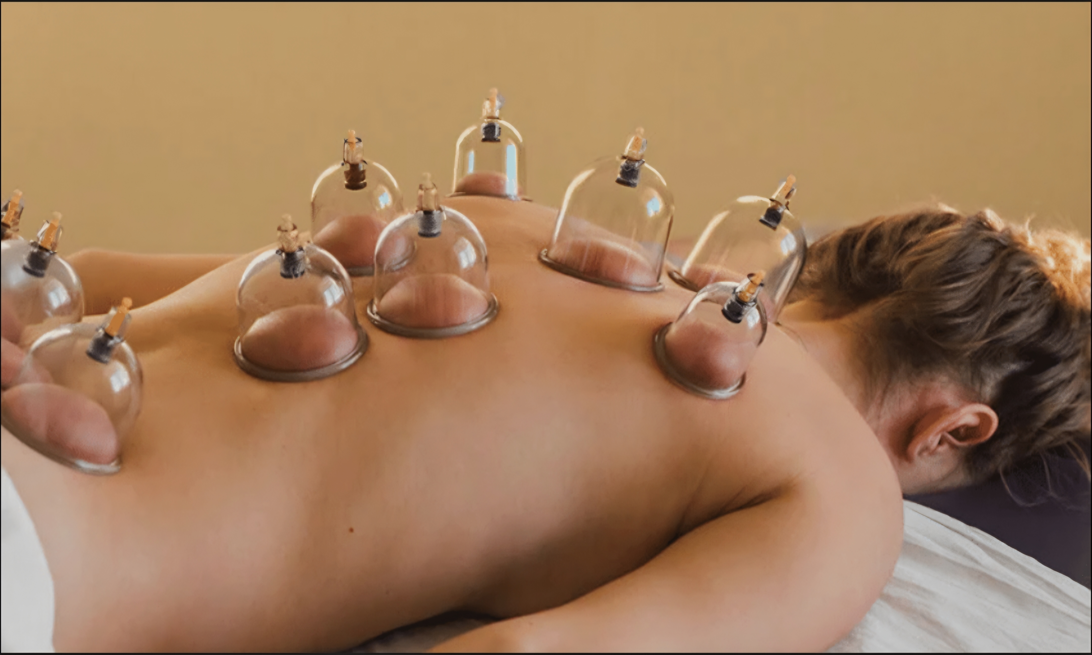 Full-Body Cupping Therapy